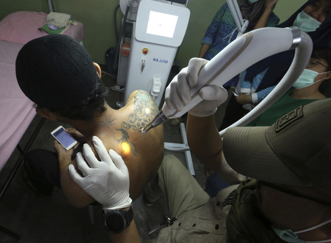 Indonesia clinic gives relief to Muslims with tattoo regrets